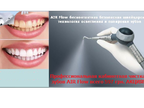 Професійна чистка зубів AIR Flow. Усього за 597 грн! Стоматологія Київ недорого якість з гарантією Київ