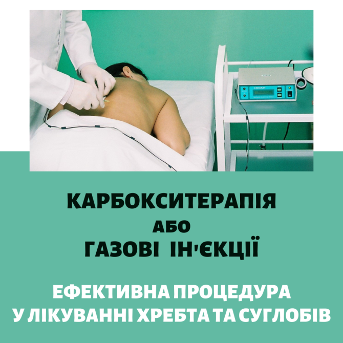 Карбокситерапія або газові уколи - сучасний метод лікування! Хмільник - изображение 1